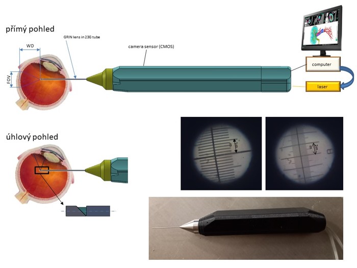 pracoviste/12110/projekty/endoskop/endoskop.jpg